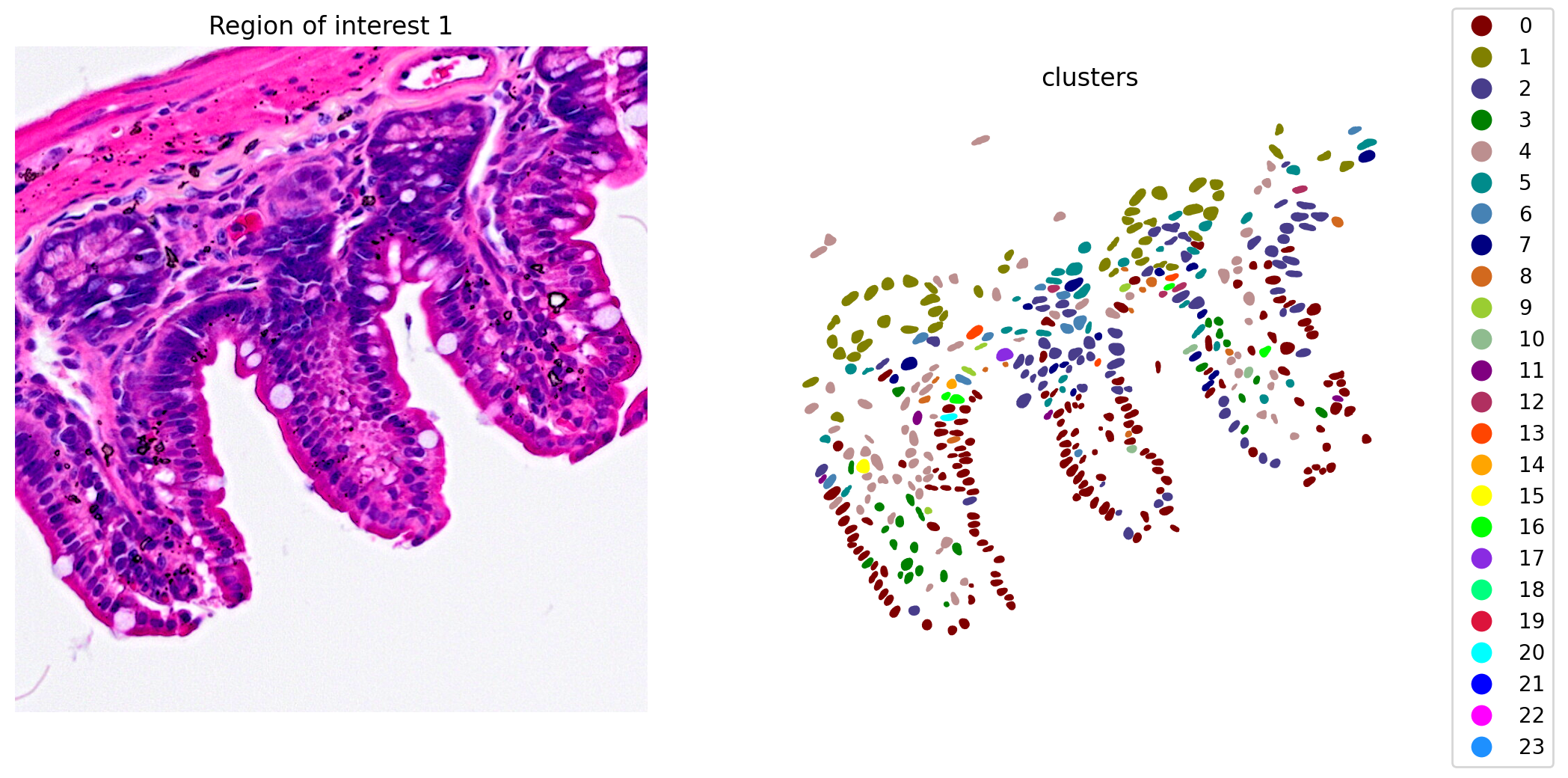 ROI clusters