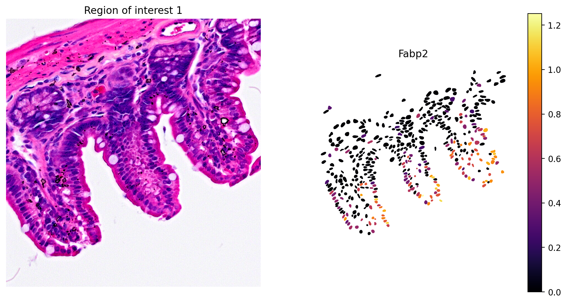 ROI Fabp2 expression