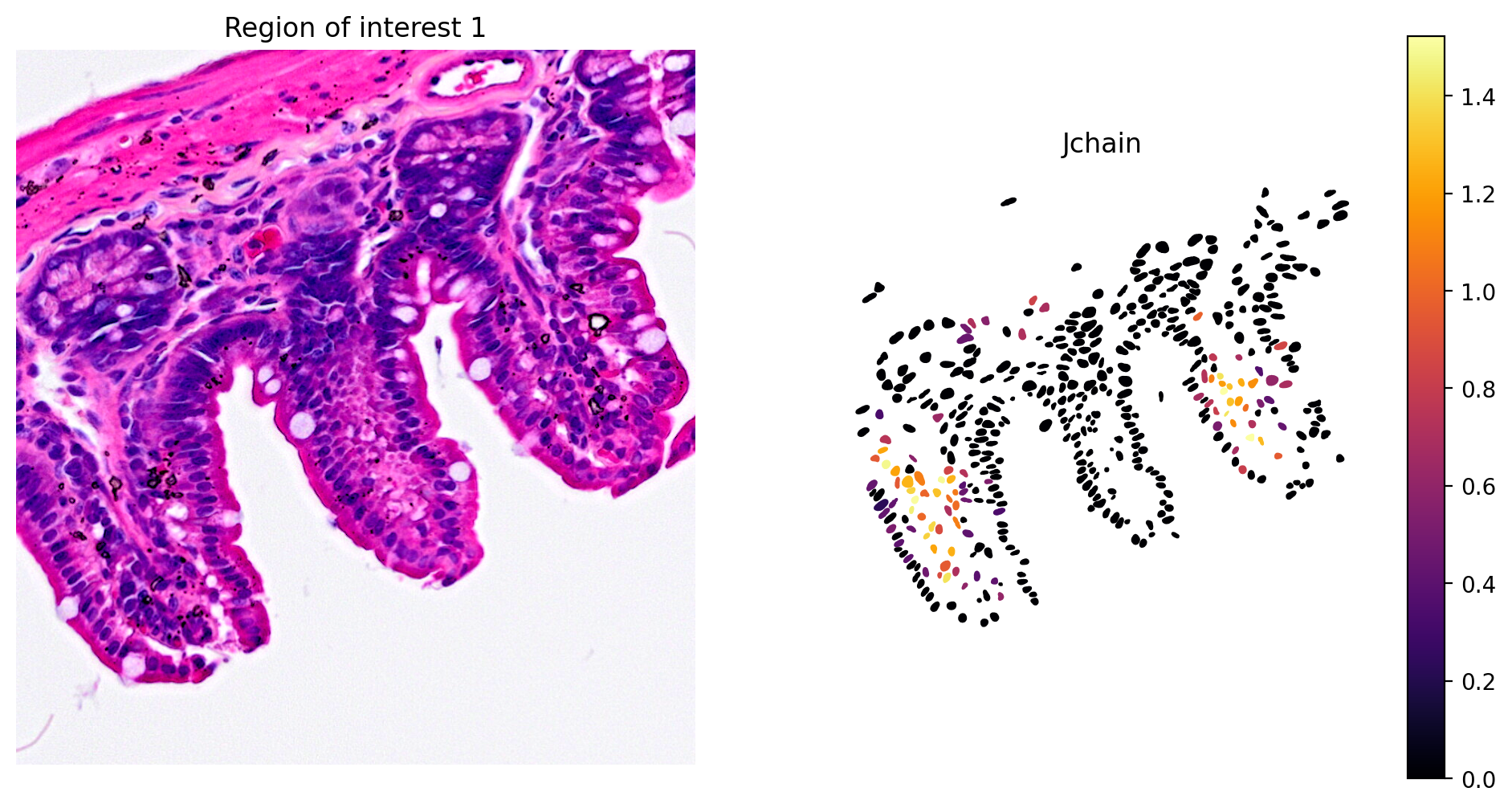 ROI Jchain expression