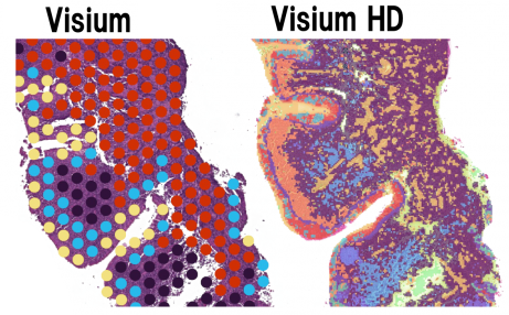 VisiumHD segmentation